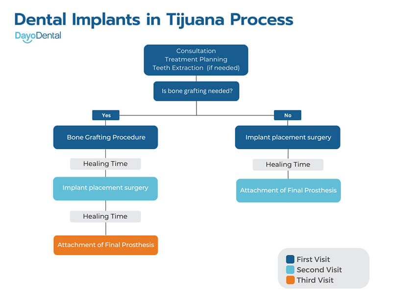 Dental Implants in Tijuana Process