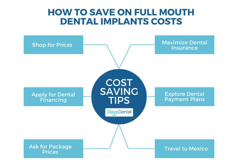 Full Mouth Dental Implants Cost Saving Tips