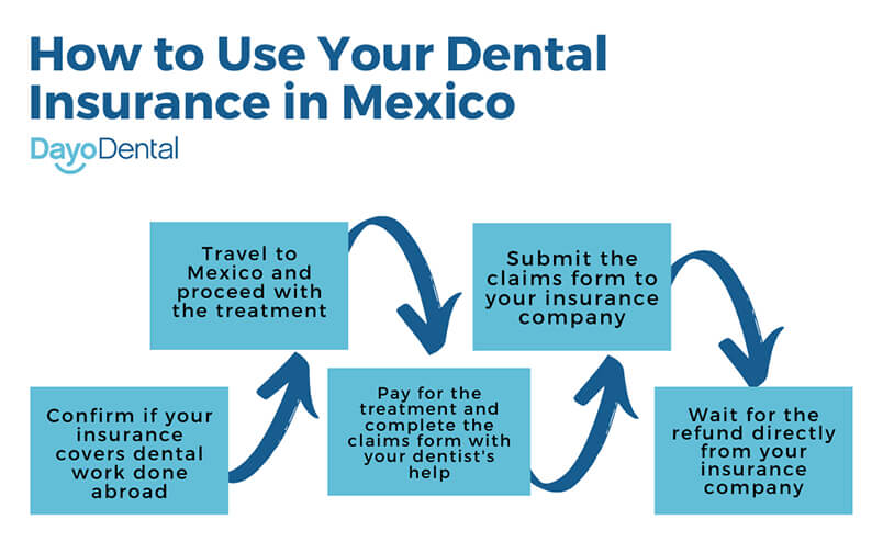 How to Use Dental Insurance in Mexico
