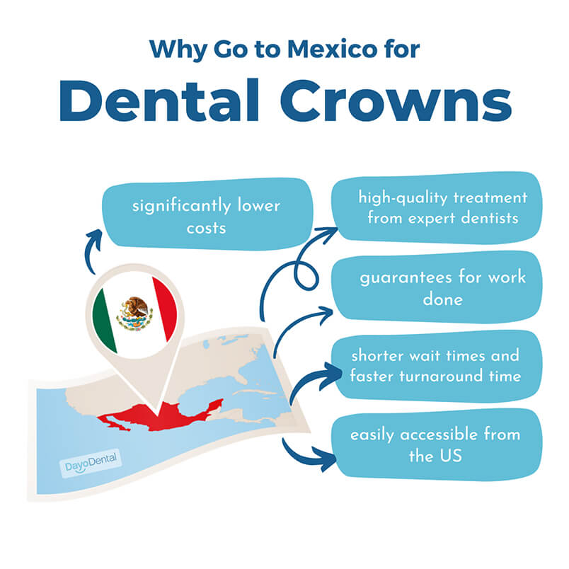 Dental Crowns Cost in Mexico