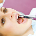 How much is a tooth extraction? Compare Average Cost.