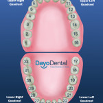 Teeth Numbers and Names: A First Step in Understanding Your Treatment Plan