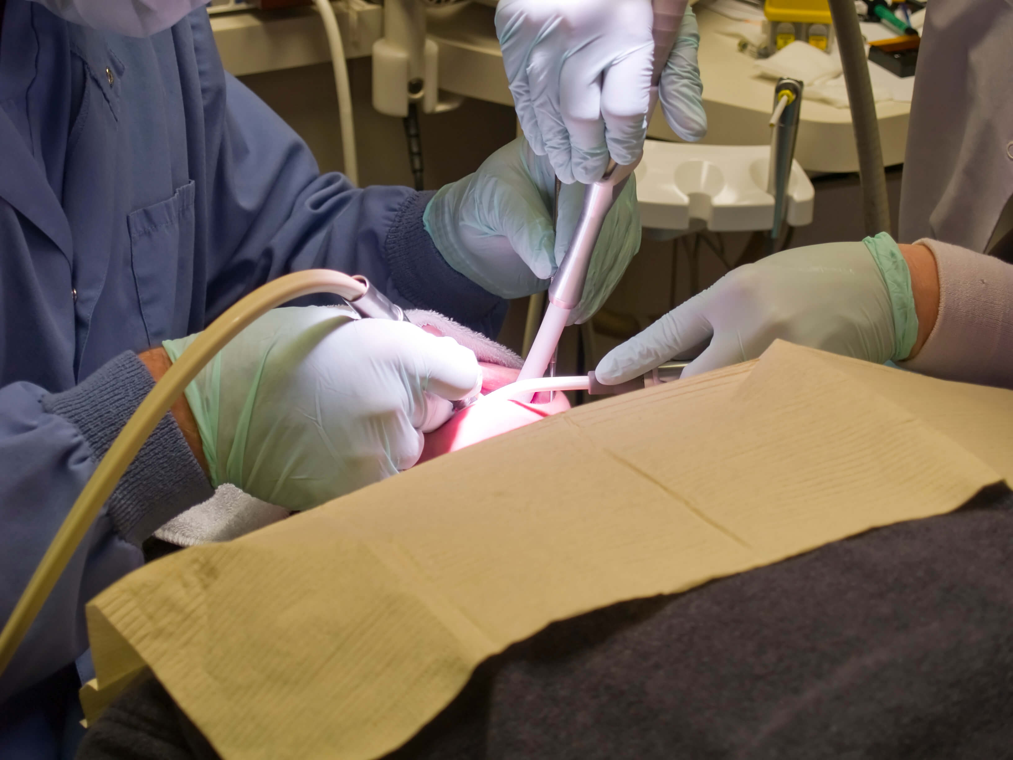 A woman undergoes a root canal at the dentist. The doctor's hands are wielding the drill and pick, and the assistant is keeping the site irrigated.