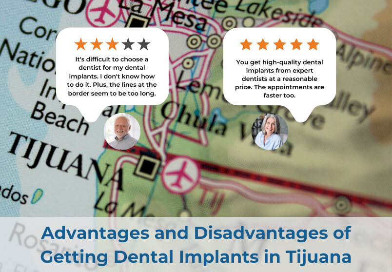 Dental Implants in Tijuana pros and cons