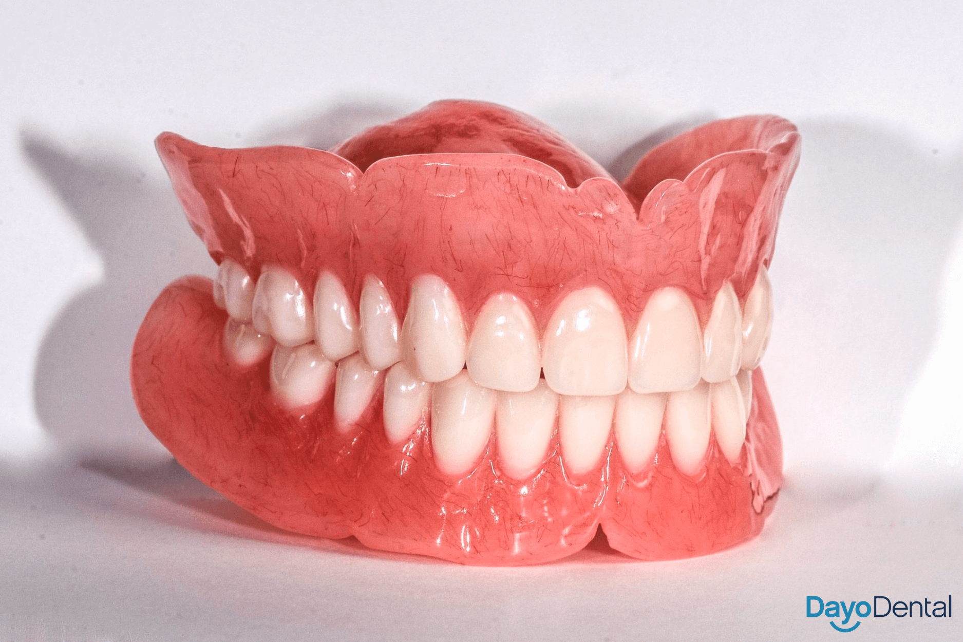 Implant supported dentures in Mexico