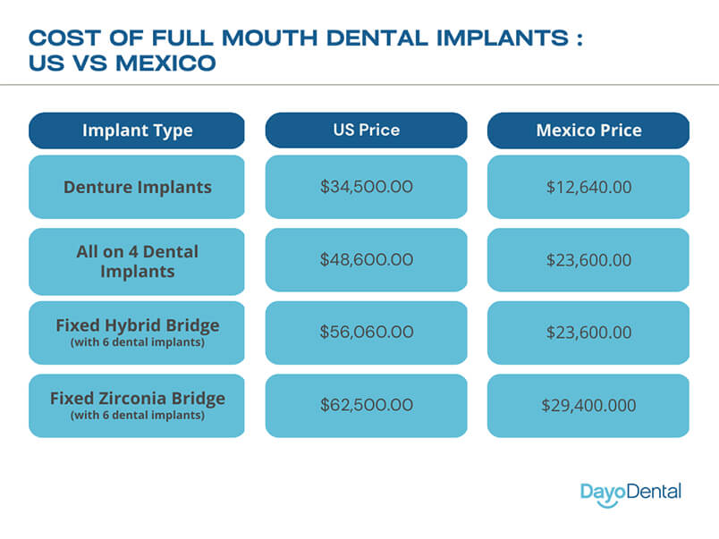 Dayo Dental Full Mouth Dental Implant Prices US vs Mexico