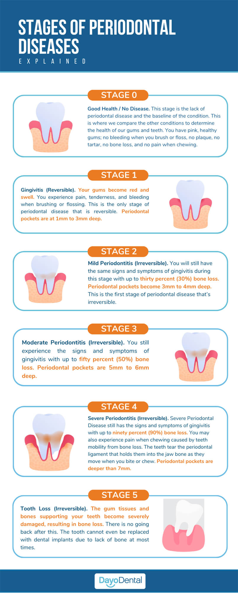 Stages of Periodontal Diseases explained Dayo Dental