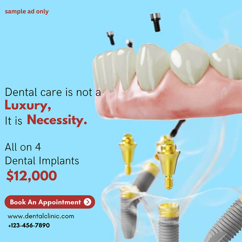 All on 4 Dental Implants Cost Sample Ad