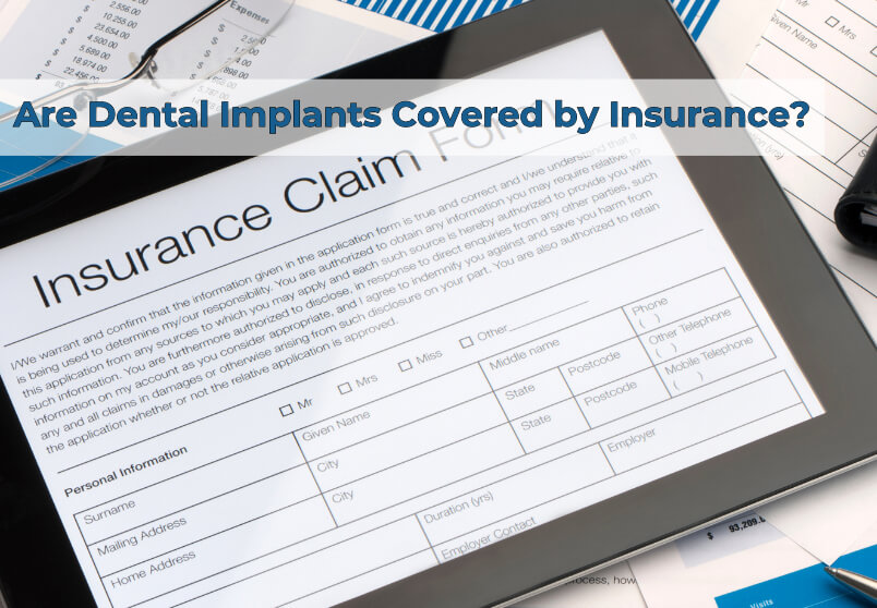 Are Dental Implants Covered by Insurance