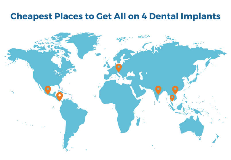 Cheapest Place to Get All on 4 Dental Implants